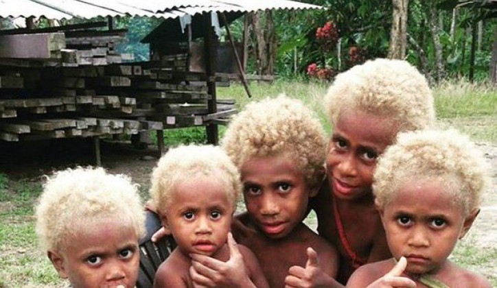 BUKA Magazin - Upoznajte jedine ljude plave kose i crne boje kože na svijetu