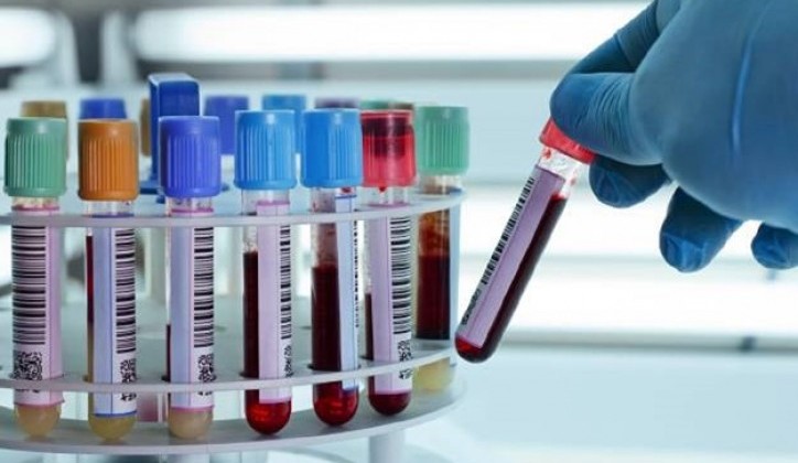 Djeca "zamorčići" dobijala krv zaraženu HIV-om: Većina njih koji su bili podvrgnuti ovim ispitivanjima danas je mrtva