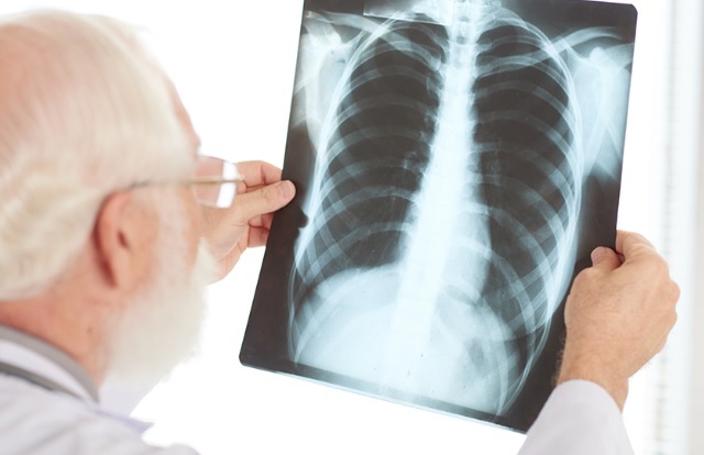 Oprez, "sindrom bijelih pluća" stigao u Evropu, posebno pogađa djecu